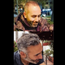 hair-transplant-turkey.com