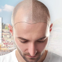 turkeyhairtransplants.co.uk